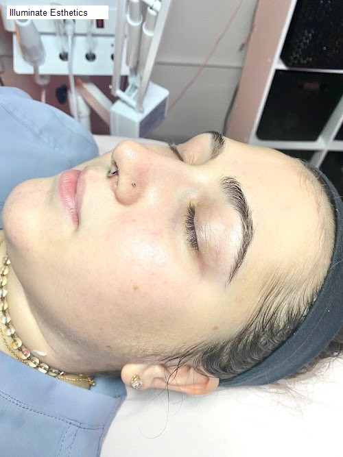 Illuminate Esthetics