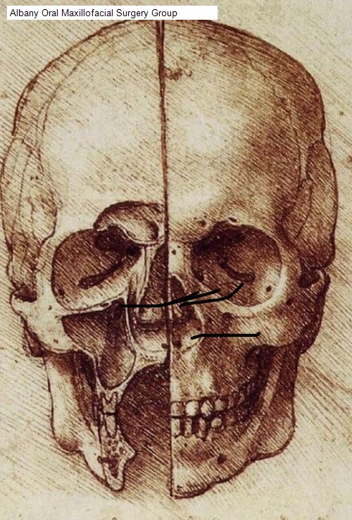 Albany Oral Maxillofacial Surgery Group