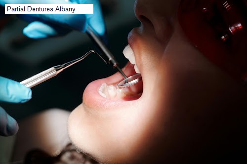 Partial Dentures Albany