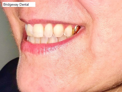 Bridgeway Dental