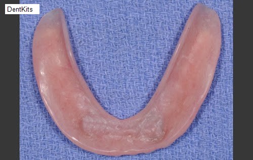 DentKits