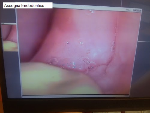 Assogna Endodontics
