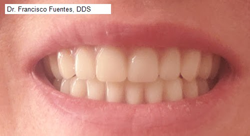 Dr. Francisco Fuentes, DDS