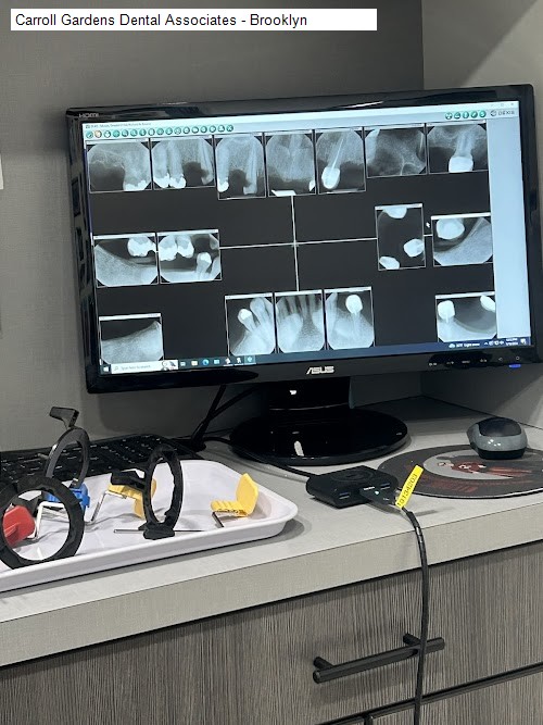 Carroll Gardens Dental Associates - Brooklyn