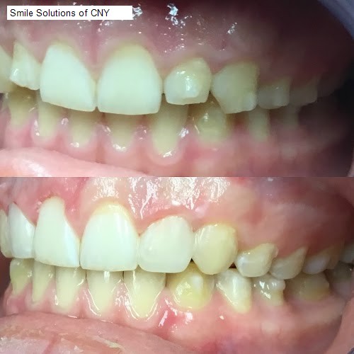 Smile Solutions of CNY