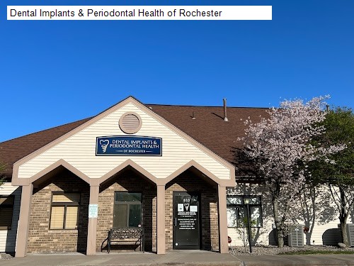 Dental Implants & Periodontal Health of Rochester