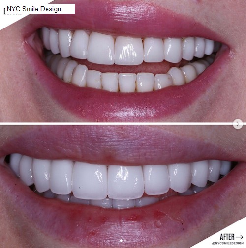 NYC Smile Design