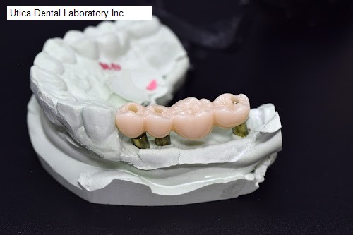 Utica Dental Laboratory Inc