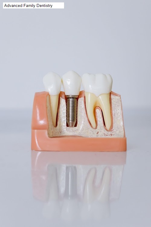 Advanced Family Dentistry