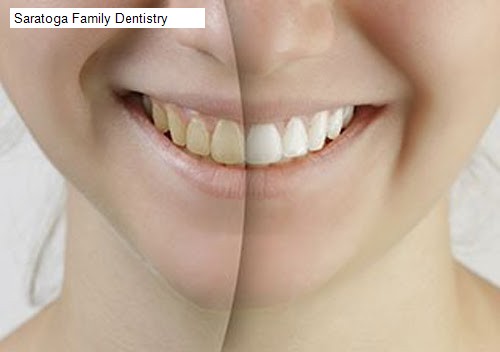 Saratoga Family Dentistry