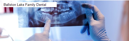 Ballston Lake Family Dental