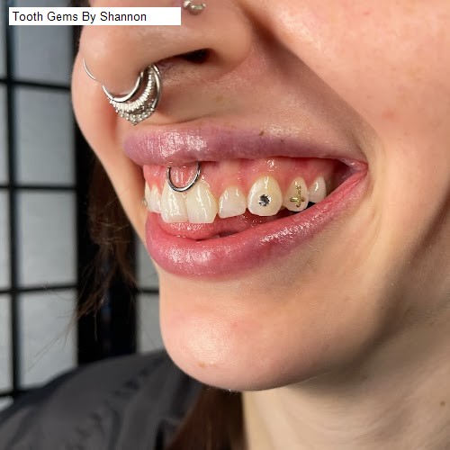 Tooth Gems By Shannon