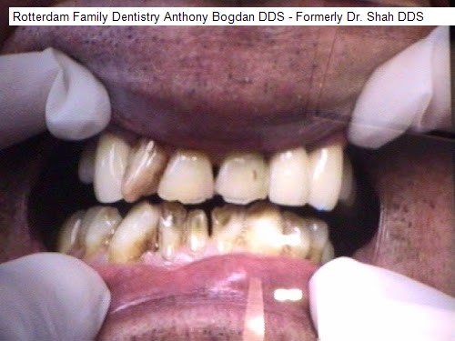 Rotterdam Family Dentistry Anthony Bogdan DDS - Formerly Dr. Shah DDS