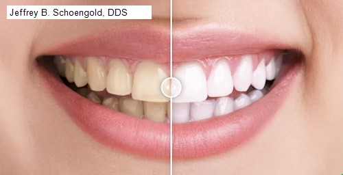 Jeffrey B. Schoengold, DDS