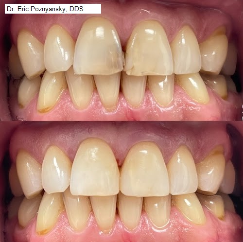 Dr. Eric Poznyansky, DDS