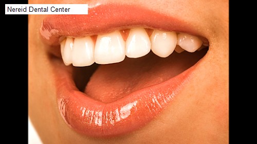 Nereid Dental Center