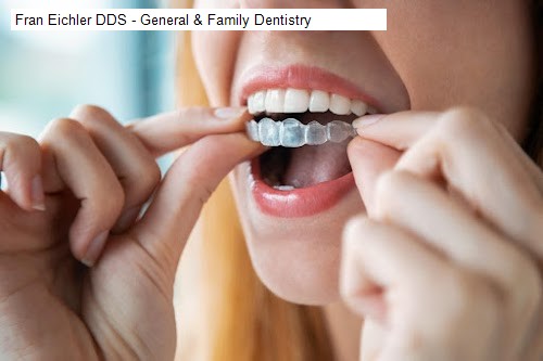 Fran Eichler DDS - General & Family Dentistry